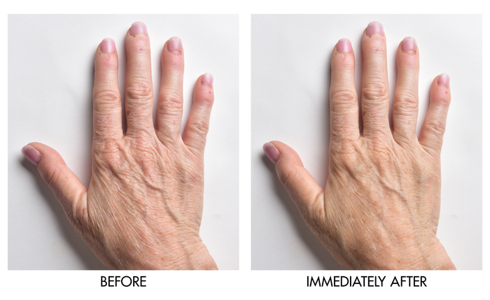 Genie Instant Hand Perfecter